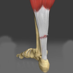 Achilles Tendon Rupture